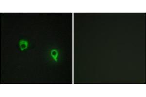 Immunofluorescence analysis of COS7 cells, using AKAP1 antibody. (AKAP1 抗体  (Internal Region))