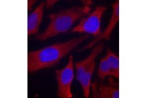 Immunofluorescence staining of methanol-fixed HeLa cells using Phospho-SYN1-S9 antibody (ABIN2987713). (SYN1 抗体  (pSer9))