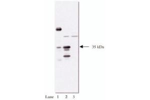 Western Blotting (WB) image for anti-HA-Tag antibody (Agarose Beads) (ABIN264383) (HA-Tag 抗体  (Agarose Beads))