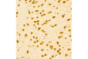 Immunohistochemistry of paraffin embedded mouse brain using BPTF (ABIN7073234) at dilution of 1:500 (400x lens) (BPTF 抗体)