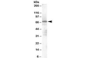 Western blot testing of human spleen lysate with PARP2 antibody at 1ug/ml. (PARP2 抗体)