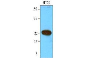 Cell lysates of HT29 (40 ug) were resolved by SDS-PAGE, transferred to nitrocellulose membrane and probed with anti-human CIB1 (1:1000). (CIB1 抗体  (AA 1-191))