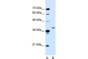 Western Blotting (WB) image for anti-Homeobox D11 (HOXD11) antibody (ABIN2460335) (HOXD11 抗体)