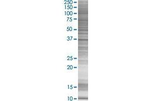 CIAPIN1 transfected lysate. (CIAPIN1 293T Cell Transient Overexpression Lysate(Denatured))