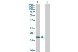 Western Blotting (WB) image for UBE2G1 293T Cell Transient Overexpression Lysate(Denatured) (ABIN1333837)