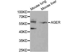 Western blot analysis of extracts of various tissues, using AGER antibody. (RAGE 抗体  (AA 30-330))