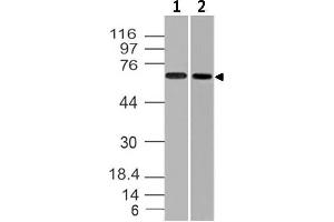 Image no. 1 for anti-Endoglin (ENG) (AA 43-287) antibody (ABIN5027187) (Endoglin 抗体  (AA 43-287))