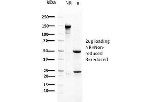 SDS-PAGE Analysis Purified RAD51 Mouse Monoclonal Antibody (RAD51/2702). (RAD51 抗体  (AA 1-134))