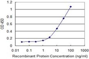 Detection limit for recombinant GST tagged HDAC6 is 0. (HDAC6 抗体  (AA 1-1063))