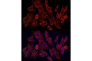 Immunofluorescence analysis of C6 cells using TIMM8A Rabbit pAb (ABIN6129145, ABIN6149172, ABIN6149173 and ABIN6225114) at dilution of 1:100 (40x lens). (TIMM8A/DDP 抗体  (AA 1-97))