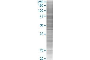 GNE transfected lysate. (GNE 293T Cell Transient Overexpression Lysate(Denatured))