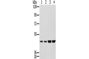 Western Blotting (WB) image for anti-Sjogren Syndrome Antigen B (SSB) antibody (ABIN2427328) (SSB 抗体)