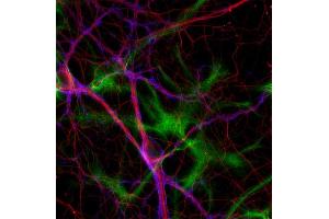 Immunocytochemistry (ICC) image for anti-Tubulin delta 2 (AA 443-449) antibody (ABIN1742551) (Tubulin delta 2 (AA 443-449) 抗体)