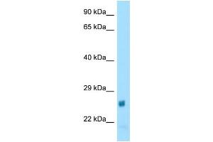 WB Suggested Anti-Naa60 Antibody Titration: 1. (NAT15 抗体  (N-Term))