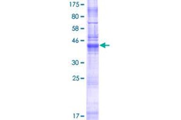 LHFPL5 Protein (AA 1-219) (GST tag)