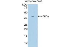 Detection of Recombinant SIGIRR, Mouse using Polyclonal Antibody to Single Ig IL1 Related Receptor (SIGIRR) (SIGIRR 抗体  (AA 1-117))