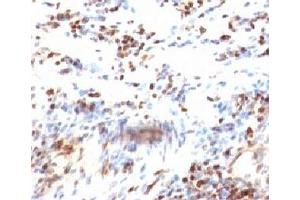 Immunohistochemistry (Formalin-fixed Paraffin-embedded Sections) (IHC (fp)) image for anti-Cyclin-Dependent Kinase Inhibitor 1B (p27, Kip1) (CDKN1B) antibody (ABIN3023779)