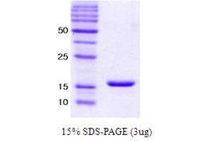 Figure annotation denotes ug of protein loaded and % gel used. (alpha Synuclein E46K (active) 蛋白)