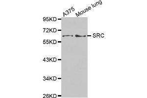 Western blot analysis of extracts of various cell lines, using SRC antibody (ABIN5970131). (Src 抗体)