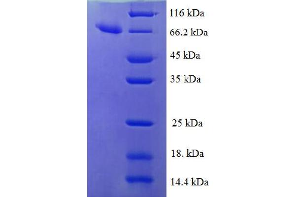 IDH3B Protein (AA 35-385) (GST tag)