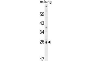 Western Blotting (WB) image for anti-PQ Loop Repeat Containing 1 (PQLC1) antibody (ABIN2995888) (PQLC1 抗体)