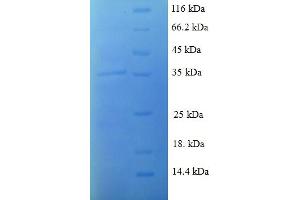 SDS-PAGE (SDS) image for Chemokine (C-C Motif) Ligand 8 (CCL8) (AA 24-99) protein (GST tag) (ABIN5709221) (CCL8 Protein (AA 24-99) (GST tag))