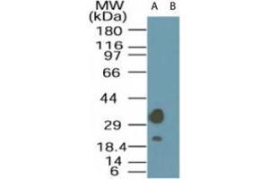 Image no. 1 for anti-STE20-Related Kinase Adaptor alpha (STRADA) (AA 300-350) antibody (ABIN200008) (STRADA 抗体  (AA 300-350))