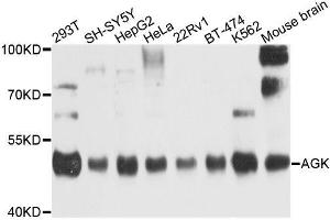 Western blot analysis of extracts of various cell lines, using AGK antibody (ABIN6003685) at 1/1000 dilution. (Acylglycerol Kinase 抗体)