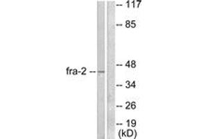 Western blot analysis of extracts from LOVO cells, using Fra-2 Antibody. (FOSL2 抗体  (AA 271-320))