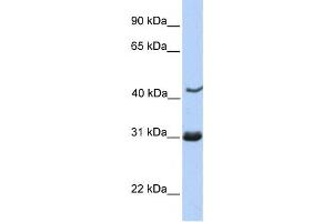 Western Blotting (WB) image for anti-Nucleoporin 35kDa (NUP35) antibody (ABIN2459542) (NUP35 抗体)