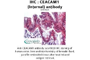 Image no. 1 for anti-Carcinoembryonic Antigen-Related Cell Adhesion Molecule 1 (CEACAM1) (Internal Region) antibody (ABIN1732947) (CEACAM1 抗体  (Internal Region))