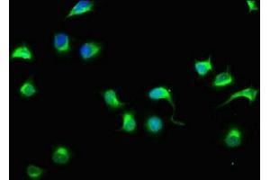 Immunofluorescence staining of A549 cells with ABIN7151029 at 1:33, counter-stained with DAPI. (HECTD3 抗体  (AA 682-785))