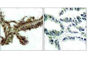 Image no. 1 for anti-V-Akt Murine Thymoma Viral Oncogene Homolog 1 (AKT1) (pThr308) antibody (ABIN196711) (AKT1 抗体  (pThr308))