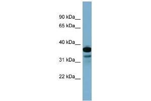 WB Suggested Anti-FLJ25791 Antibody Titration: 0. (FLJ25791 (Middle Region) 抗体)