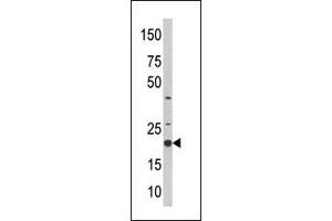 Western blot analysis of anti-SKP1A Pab (ABIN388650 and ABIN2838369) in CEM cell line lysate (35 μg/lane). (SKP1 抗体  (AA 58-87))