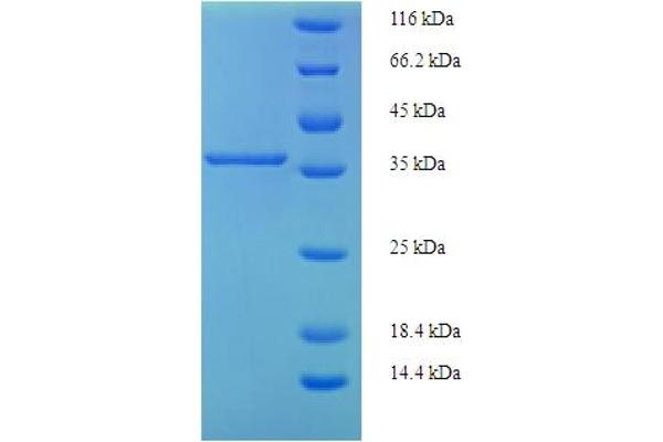 PIGX Protein (AA 42-230, partial) (His-SUMO Tag)