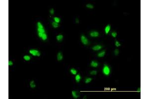 Immunofluorescence (IF) image for anti-Ubiquitin-Conjugating Enzyme E2C (UBE2C) (AA 70-179) antibody (ABIN564800)