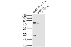 Lane 1: SARS-CoV-2 N Protein; Lane 2: Recombinant SARS N (1-422) protein; Lane 3: MERS N protein probed with SARS Nucleocapsid Protein (14B3D) Monoclonal Antibody, Unconjugated (bsm-49134M) at 1:1000 dilution and 4˚C overnight incubation. (SARS-Coronavirus Nucleocapsid Protein (SARS-CoV N) 抗体)