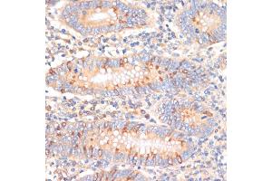 Immunohistochemistry of paraffin-embedded human appendix using WNK3 antibody (ABIN6132518, ABIN6150236, ABIN6150237 and ABIN6221221) at dilution of 1:100 (40x lens). (WNK3 抗体)