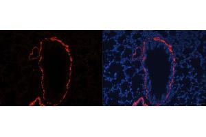 Immunofluorescence analysis of rat lung using ACTA2 antibody. (Smooth Muscle Actin 抗体)