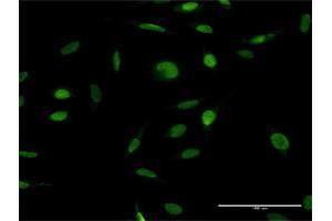 Immunofluorescence of purified MaxPab antibody to ZFP42 on HeLa cell. (ZFP42 抗体  (AA 1-310))