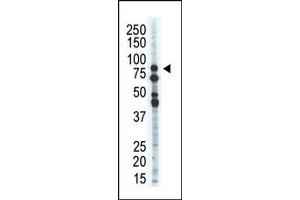 Western Blotting (WB) image for anti-Salt-Inducible Kinase 1 (SIK1) (C-Term) antibody (ABIN360572) (SIK1 抗体  (C-Term))