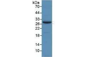 Western Blotting (WB) image for alpha-2-Macroglobulin (A2M) ELISA Kit (ABIN6574245)