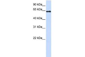 WB Suggested Anti-PAPSS2 Antibody Titration:  0. (PAPSS2 抗体  (C-Term))