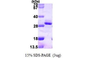 RGS2 Protein (AA 1-211) (His tag)