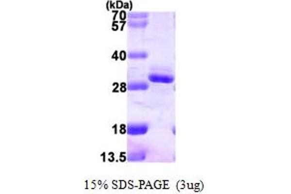 RGS2 Protein (AA 1-211) (His tag)