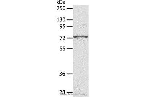 Western blot analysis of PC3 cell, using ADAM10 Polyclonal Antibody at dilution of 1:300 (ADAM10 抗体)