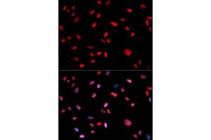 Immunofluorescence (IF) image for anti-Jun Proto-Oncogene (JUN) (pThr239) antibody (ABIN1870293) (C-JUN 抗体  (pThr239))