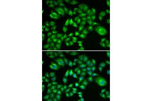 Immunofluorescence analysis of A549 cells using H6PD antibody (ABIN5973840). (Glucose-6-Phosphate Dehydrogenase 抗体)