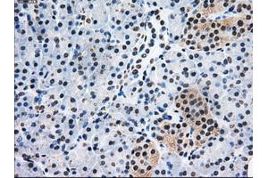 Immunohistochemical staining of paraffin-embedded Kidney tissue using anti-PSMD10mouse monoclonal antibody. (PSMD10 抗体)